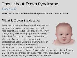 Why Do People with Down Syndrome Look the Same? Unraveling the Genetic Basis of Shared Features